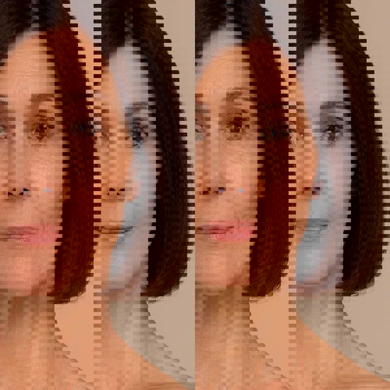 DrenaFace – Escova de Drenagem Linfática Facial + Creme De Brinde DrenaFace – Escova de Drenagem Linfática Facial Borsato 