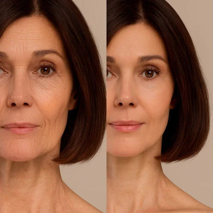 DrenaFace – Escova de Drenagem Linfática Facial + Creme De Brinde DrenaFace – Escova de Drenagem Linfática Facial Borsato 