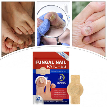 UngiGel - Adesivos para fungos UngiGel Borsato 